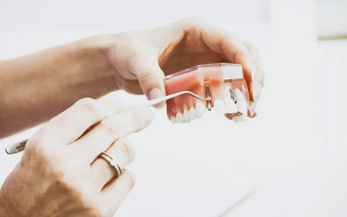 Dental instruments laid out sterile
